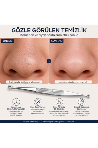 Çift Taraflı Komedon Temizleme Aleti Siyah Nokta Temizleyici Paslanmaz Çelik
